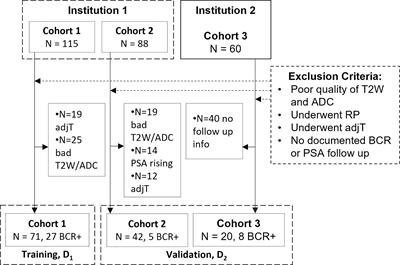 Prostate Surface Distension and Tumor Texture Descriptors From Pre-Treatment MRI Are Associated With Biochemical Recurrence Following Radical Prostatectomy: Preliminary Findings